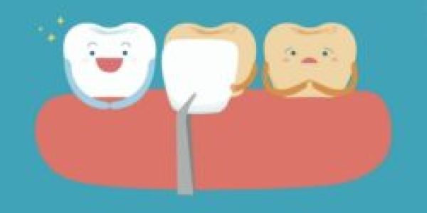 ACHIZITIE DIRECTA CONSUMABILE DENTARE, MEDICAMENTE SI INSTRUMENTAR DENTAR